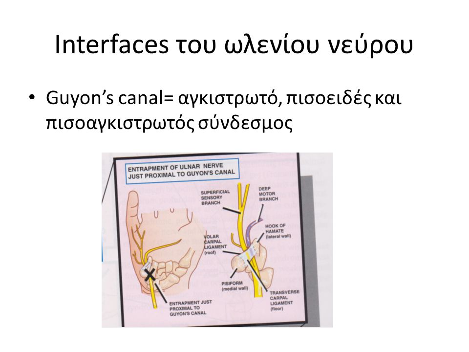 Interfaces του ωλενίου νεύρου Guyon’s canal= αγκιστρωτό, πισοειδές και πισοαγκιστρωτός σύνδεσμος