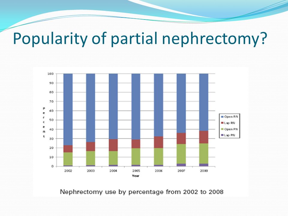 Popularity of partial nephrectomy