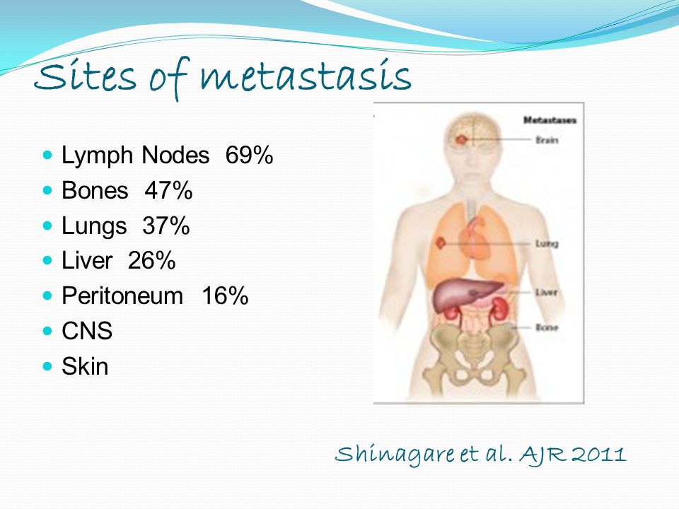 Sites of metastasis Lymph Nodes 69% Bones 47% Lungs 37% Liver 26% Peritoneum 16% CNS Skin Shinagare et al.