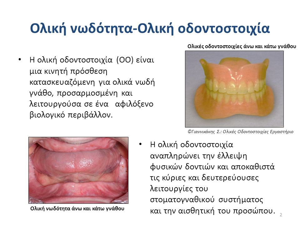 Ολική νωδότητα-Ολική οδοντοστοιχία Η ολική οδοντοστοιχία (ΟΟ) είναι μια κινητή πρόσθεση κατασκευαζόμενη για ολικά νωδή γνάθο, προσαρμοσμένη και λειτουργούσα σε ένα αφιλόξενο βιολογικό περιβάλλον.
