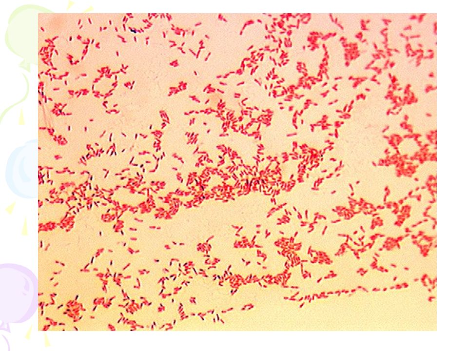 Bordetella pertussis iga. Иерсиния пестис микроскопия. Окраска сальмонелл по грамму. Синегнойная палочка микроскопия. Pseudomonas aeruginosa микробиология.