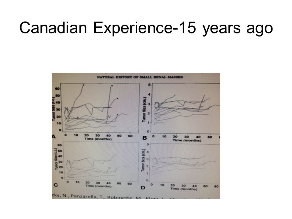 Canadian Experience-15 years ago