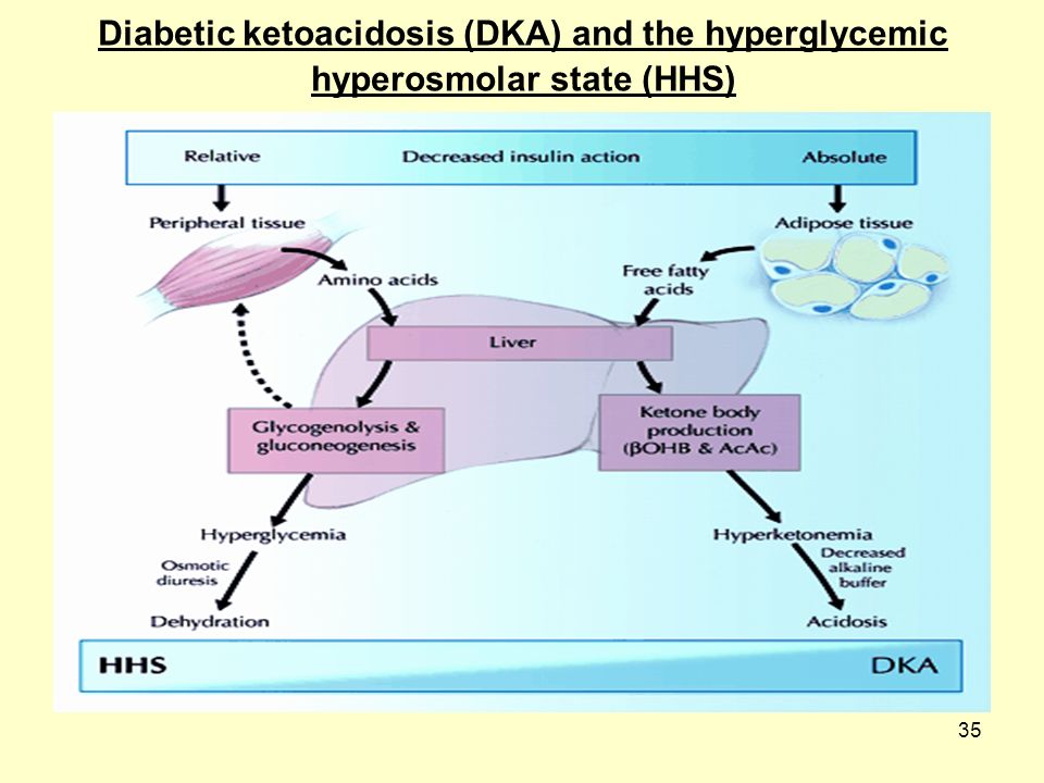35 Diabetic ketoacidosis (DKA) and the hyperglycemic hyperosmolar state (HHS)