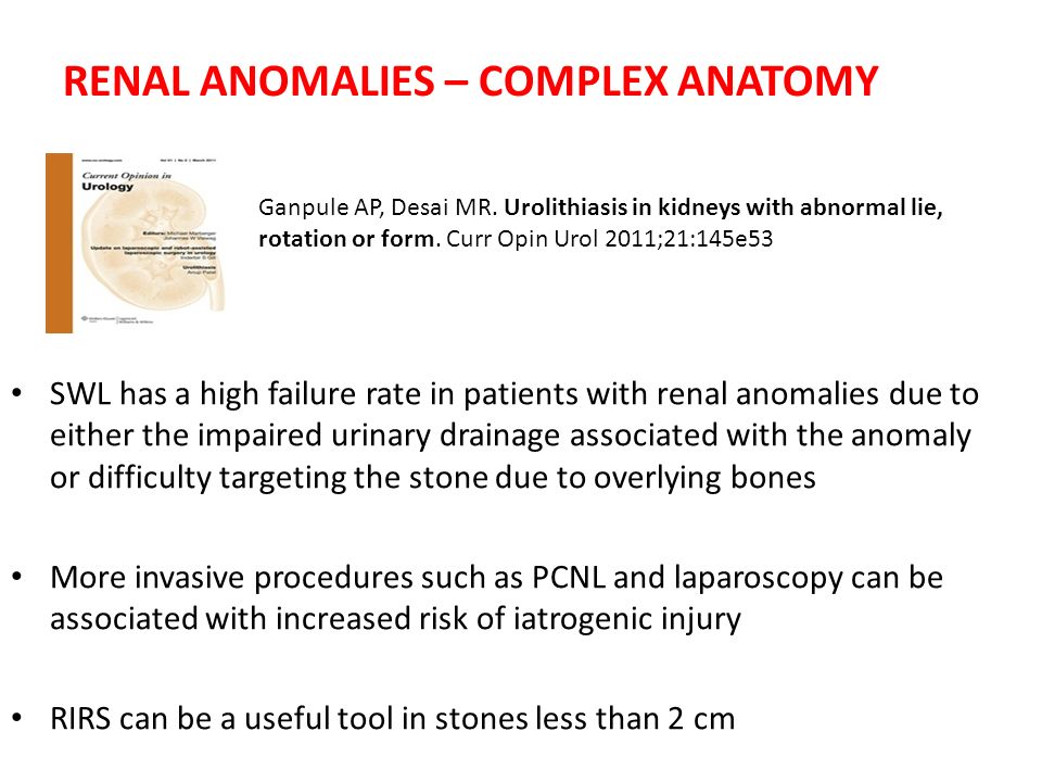 RENAL ANOMALIES – COMPLEX ANATOMY SWL has a high failure rate in patients with renal anomalies due to either the impaired urinary drainage associated with the anomaly or difficulty targeting the stone due to overlying bones More invasive procedures such as PCNL and laparoscopy can be associated with increased risk of iatrogenic injury RIRS can be a useful tool in stones less than 2 cm Ganpule AP, Desai MR.