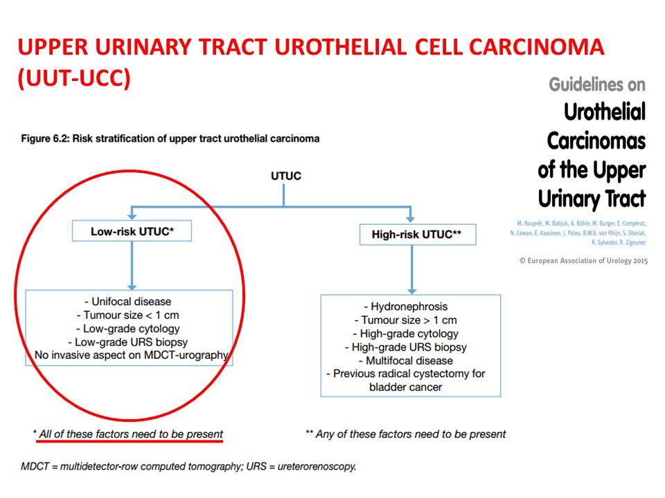 UPPER URINARY TRACT UROTHELIAL CELL CARCINOMA (UUT-UCC)