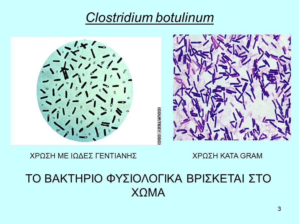 3 Clostridium botulinum ΧΡΩΣΗ ΜΕ ΙΩΔΕΣ ΓΕΝΤΙΑΝΗΣΧΡΩΣΗ ΚΑΤΑ GRAM ΤΟ ΒΑΚΤΗΡΙΟ ΦΥΣΙΟΛΟΓΙΚΑ ΒΡΙΣΚΕΤΑΙ ΣΤΟ ΧΩΜΑ