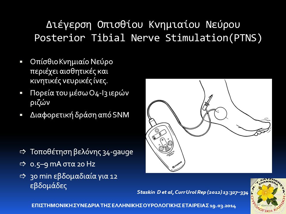Διέγερση Οπισθίου Κνημιαίου Νεύρου Posterior Tibial Nerve Stimulation(PTNS)  Οπίσθιο Κνημιαίο Νεύρο περιέχει αισθητικές και κινητικές νευρικές ίνες.