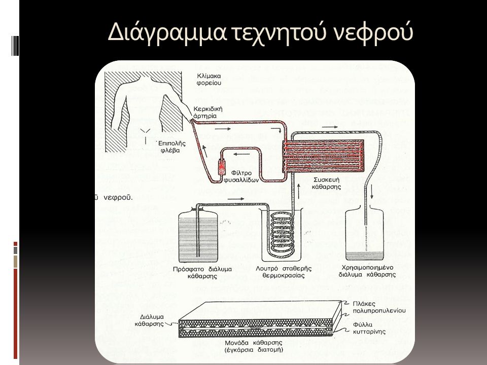 Διάγραμμα τεχνητού νεφρού