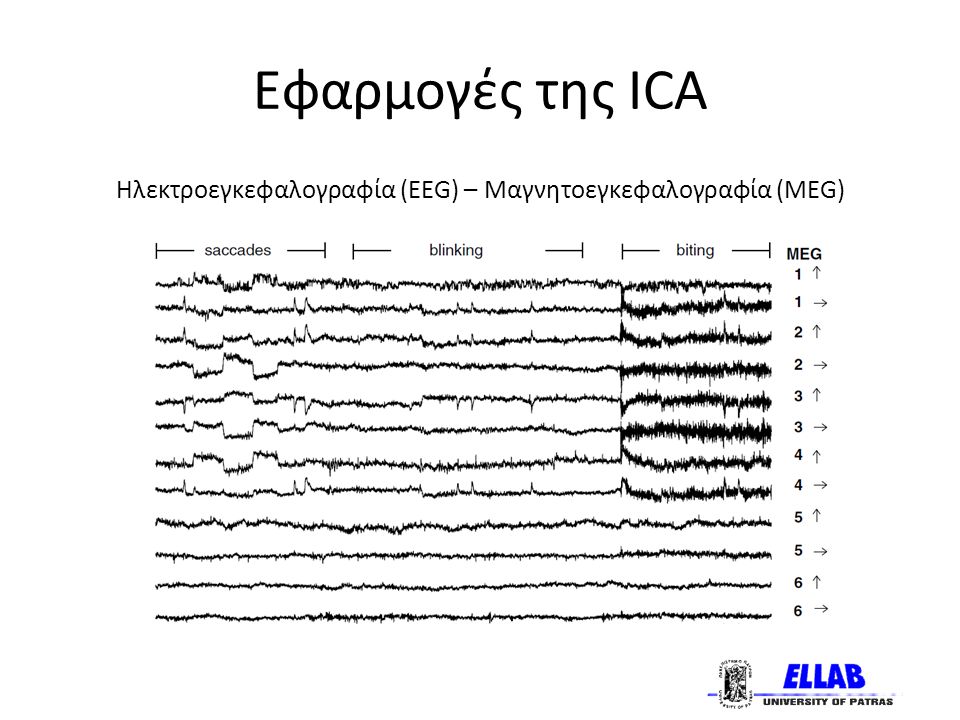 Εφαρμογές της ICA Ηλεκτροεγκεφαλογραφία (EEG) – Μαγνητοεγκεφαλογραφία (MEG)